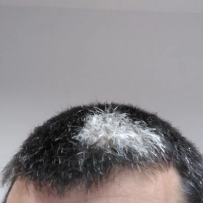 Garko-ren avatar